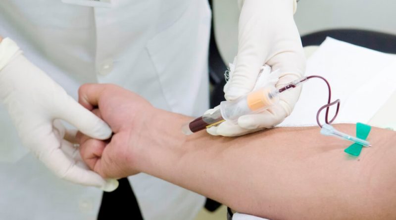 Unidades começam a agendar exames de laboratório