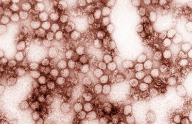 Vírus da febre amarela é detectado em urina e sêmen quase um mês após a infecção