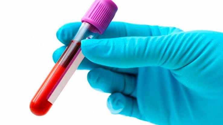 Exames para diabetes e doença renal terão parâmetros nacionais