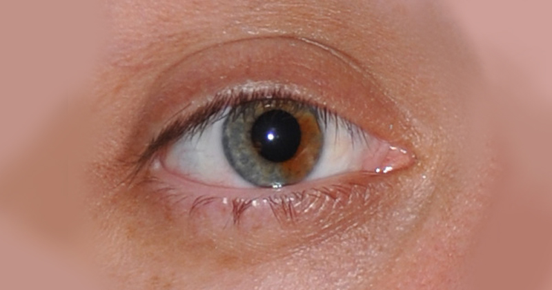 Agentes de saúde fazem busca ativa de casos de conjuntivite tracoma