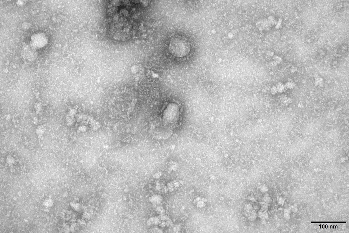 Governo cria grupo para monitorar casos de coronavírus