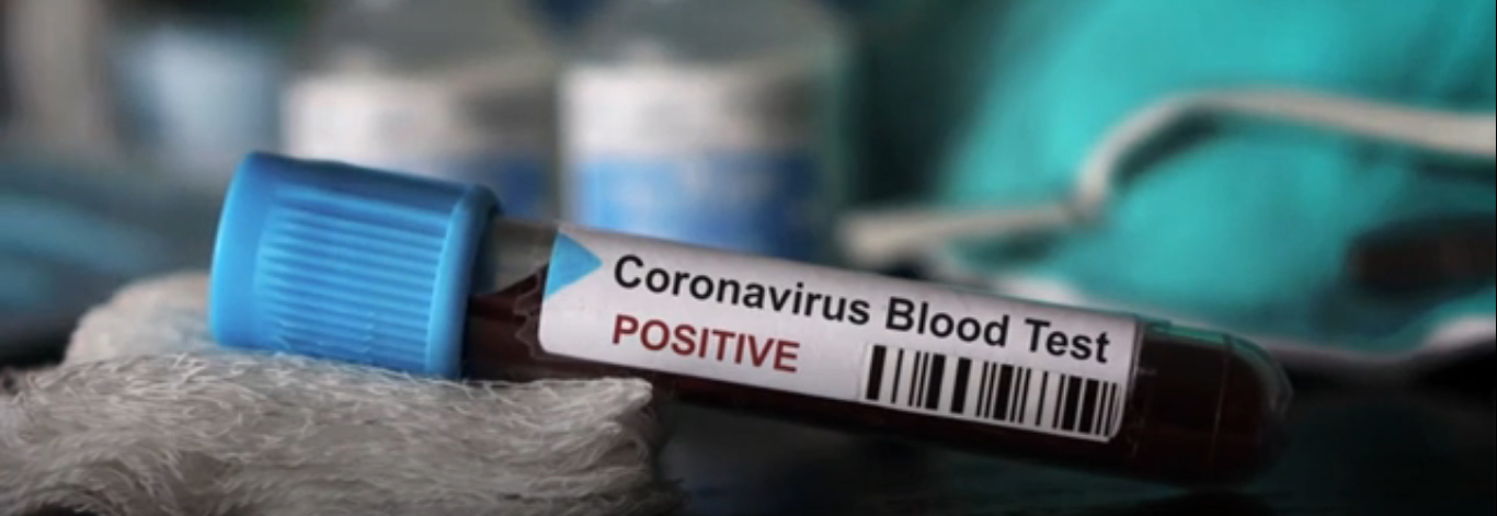 Coronavírus chega ao Brasil