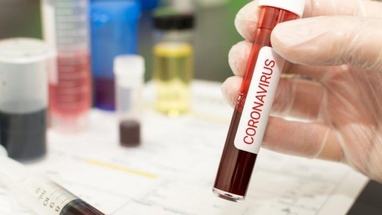 Taubaté soma 20 casos confirmados de coronavírus