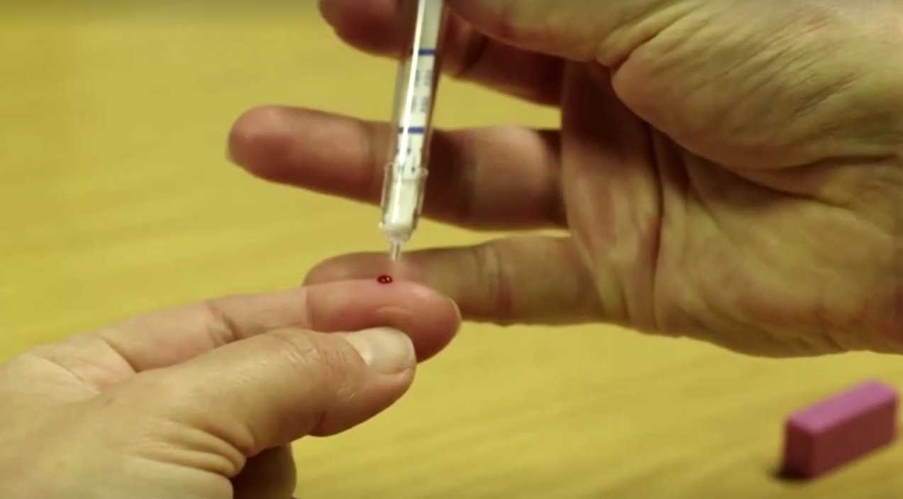 Anvisa libera testes rápidos de coronavírus em farmácias