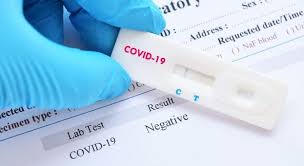 Farmácias de Manipulação passam a oferecer testes rápidos para Coronavírus