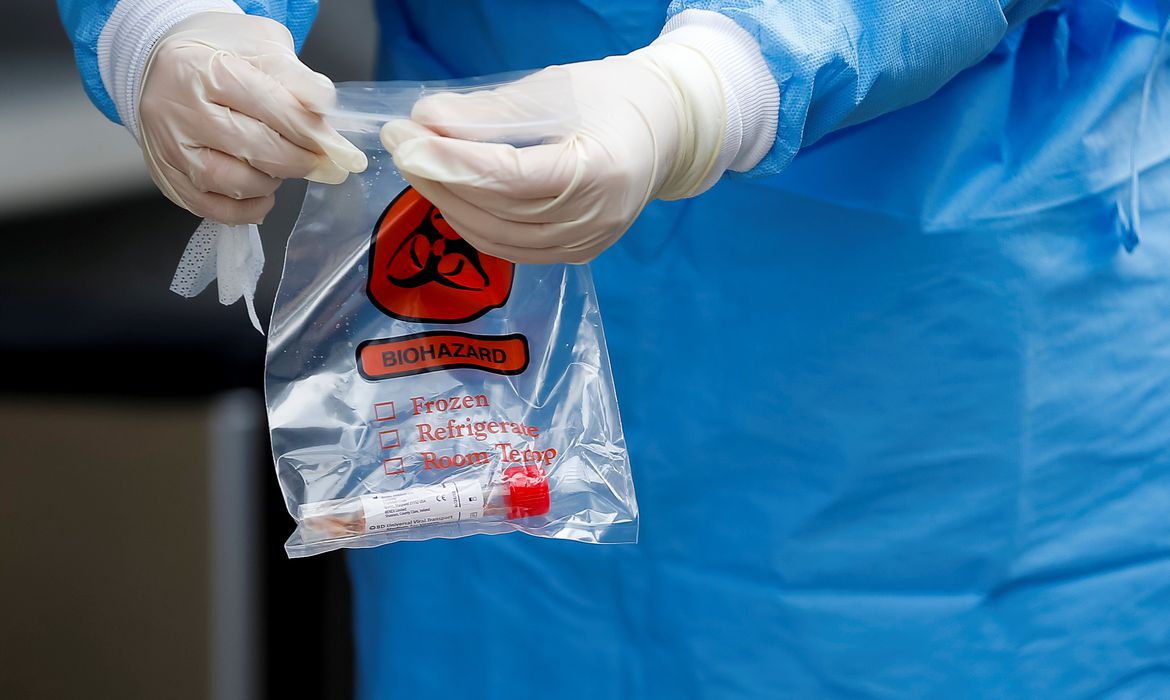 Tipo sanguíneo e genes estão ligados à Covid-19 grave, mostra estudo