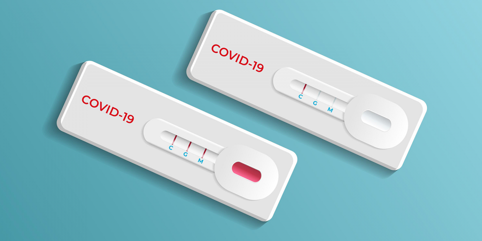 SEST SENAT vai realizar testes rápidos de covid-19 em 30 mil trabalhadores do transporte