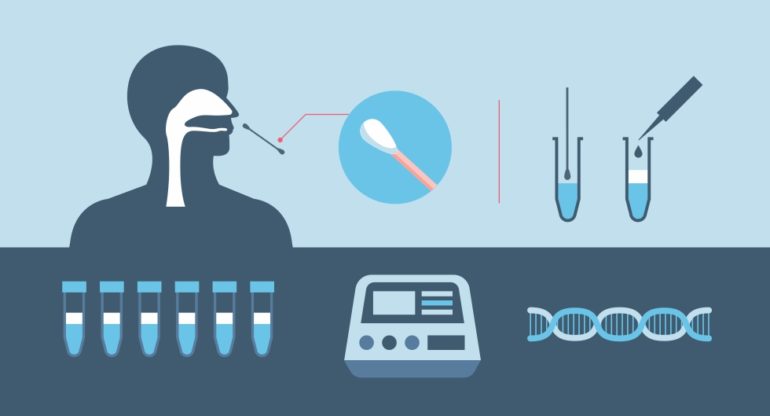 Testagem gratuita para Covid-19 é ampliada em Ubatuba