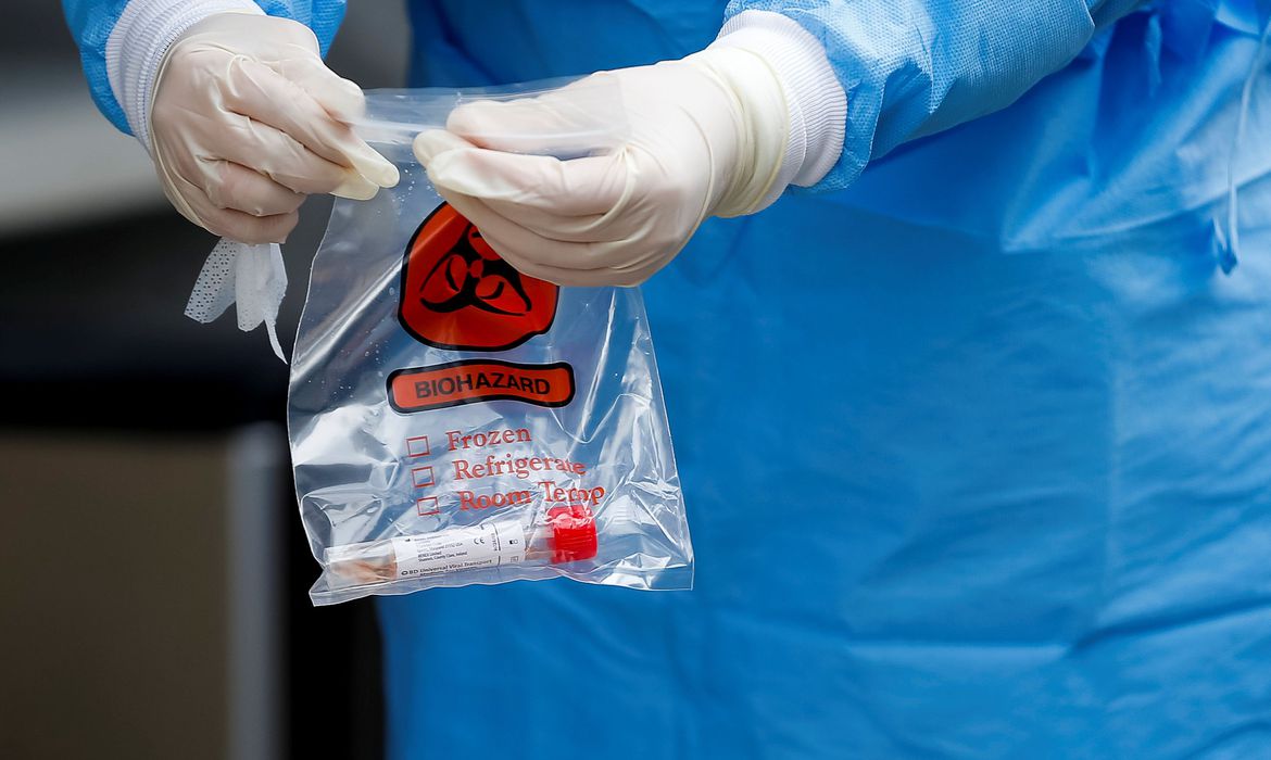 Governo de SP inicia testagem para Covid-19 na rede estadual