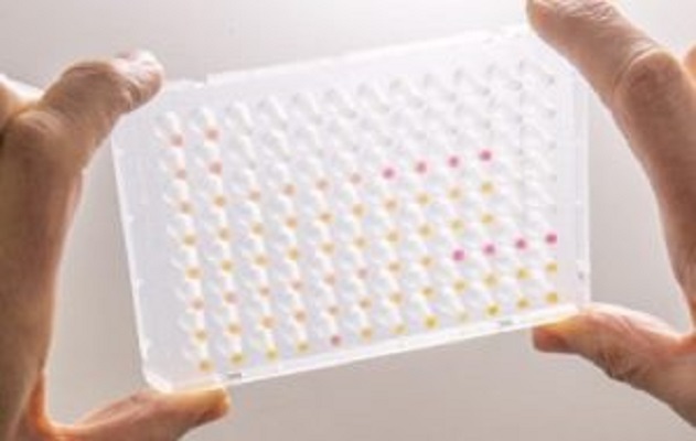 Startup desenvolve teste de diagnóstico de COVID-19 a partir de levedura