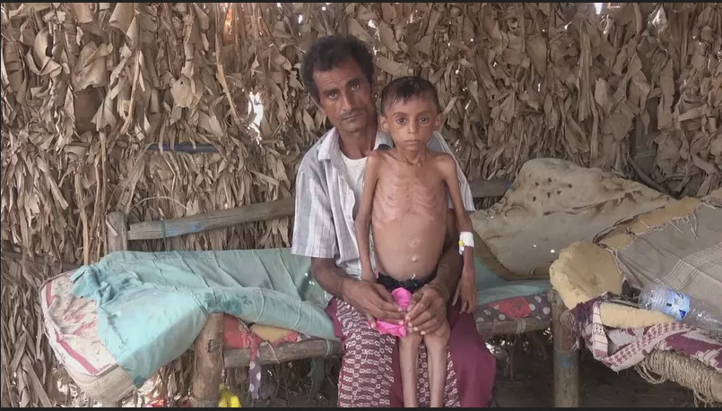 Inflação e pandemia podem empurrar Brasil de volta ao Mapa da Fome
