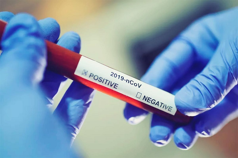 Fiocruz alerta para alta de casos de covid-19 em quatro estados