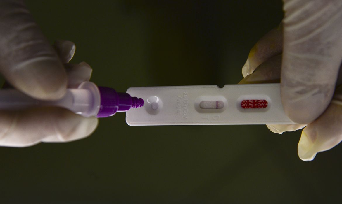 Hospitalizações por covid-19 mantêm tendência de alta nos Estados