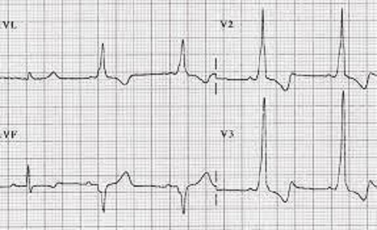 Prefeitura de Taubaté realiza exames de eletrocardiograma aos sábados