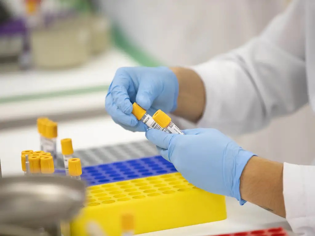 Secretaria de Saúde inicia descentralização de coletas de exames